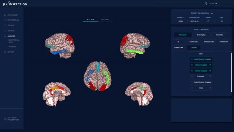 ATROSCAN의 뇌 MR 영상 분석 화면 (출처: 제이엘케이인스펙션)