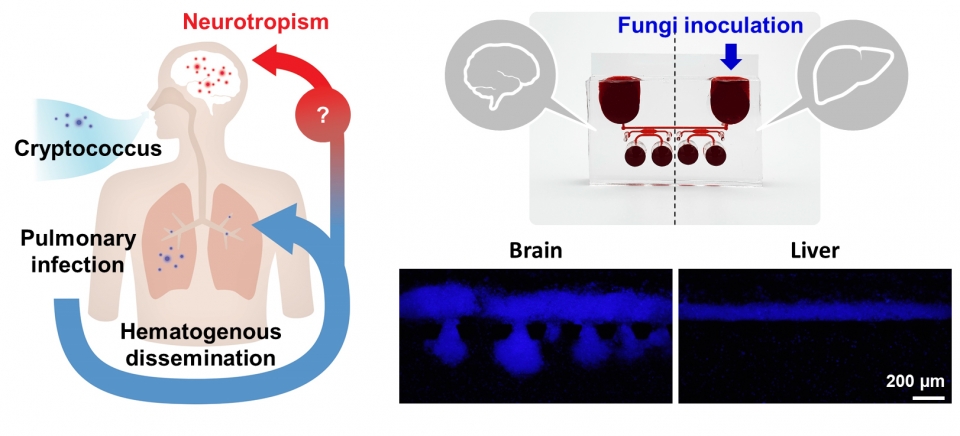 뇌수막염 유발 곰팡이의 뇌 조직 친화성 모델링(사진=연세대 조승우 교수)