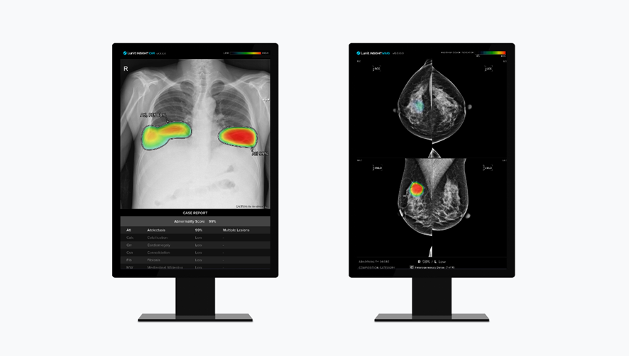 루닛 흉부 엑스레이 AI 영상 분석 솔루션 '루닛 인사이트 CXR'(왼쪽)과 유방촬영술 AI 영상 분석 솔루션 '루닛 인사이트 MMG'(사진=루닛)