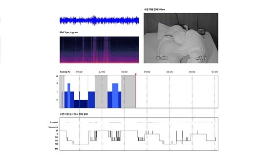 에이슬립의 수면 측정 AI 모델 시연 모습(사진=에이슬립)
