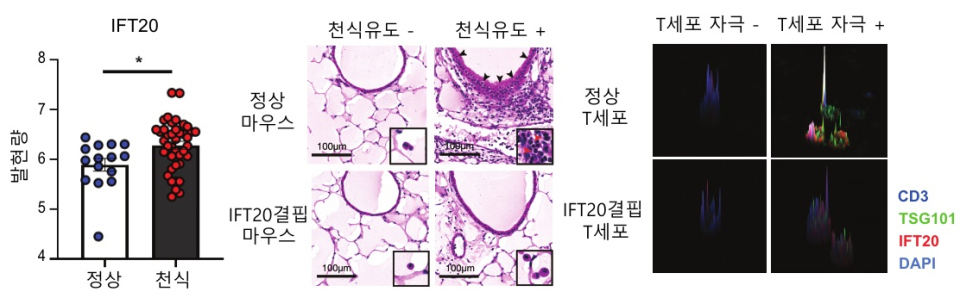 정상인에 비해서 천식 환자에게서 혈액 내의 IFT20 발현량이 증가되어 있다. T세포에 국한되어 IFT20이 결핍된 마우스는 정상 마우스에 비해서 천식 유도가 잘 되지 않고, IFT20이 결핍된 T세포는 정상 T세포에 비해 면역학적 시냅스 형성이 잘 되지 않는다(사진=KAIST)